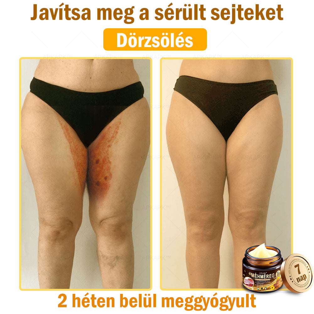 𝐀𝐏𝐊𝐀𝐏𝐊™ 𝐌é𝐡𝐦é𝐫𝐞𝐠 𝐁ő𝐫𝐫𝐞𝐠𝐞𝐧𝐞𝐫á𝐥ó 𝐊𝐫é𝐦 🧑‍⚕️ 🧑‍⚕️𝐀 𝐛ő𝐫𝐩𝐫𝐨𝐛𝐥é𝐦á𝐤 𝐤𝐞𝐳𝐞𝐥é𝐬𝐞 𝐦𝐚𝐠á𝐛𝐚𝐧 𝐟𝐨𝐠𝐥𝐚𝐥𝐣𝐚: é𝐥𝐞𝐭𝐤𝐨𝐫𝐢 𝐟𝐨𝐥𝐭𝐨𝐤, 𝐡𝐞𝐠𝐞𝐤, 𝐬𝐳𝐞𝐦ö𝐥𝐜𝐬ö𝐤, 𝐛ő𝐫𝐧ö𝐯𝐞𝐝é𝐤𝐞𝐤, 𝐭á𝐥𝐲𝐨𝐠𝐨𝐤, 𝐩𝐚𝐭𝐭𝐚𝐧á𝐬𝐨𝐤, 𝐞𝐤𝐜é𝐦𝐚, 𝐩𝐬𝐨𝐫𝐢𝐚𝐬𝐢𝐬, 𝐚𝐜𝐧𝐞 𝐢𝐧𝐯𝐞𝐫𝐬𝐚, 𝐫á𝐧𝐜𝐨𝐤, 𝐛ő𝐫ö𝐫𝐞𝐠𝐞𝐝é𝐬 é𝐬 𝐞𝐠𝐲é𝐛 𝐩𝐫𝐨𝐛𝐥é𝐦á𝐤 🔥