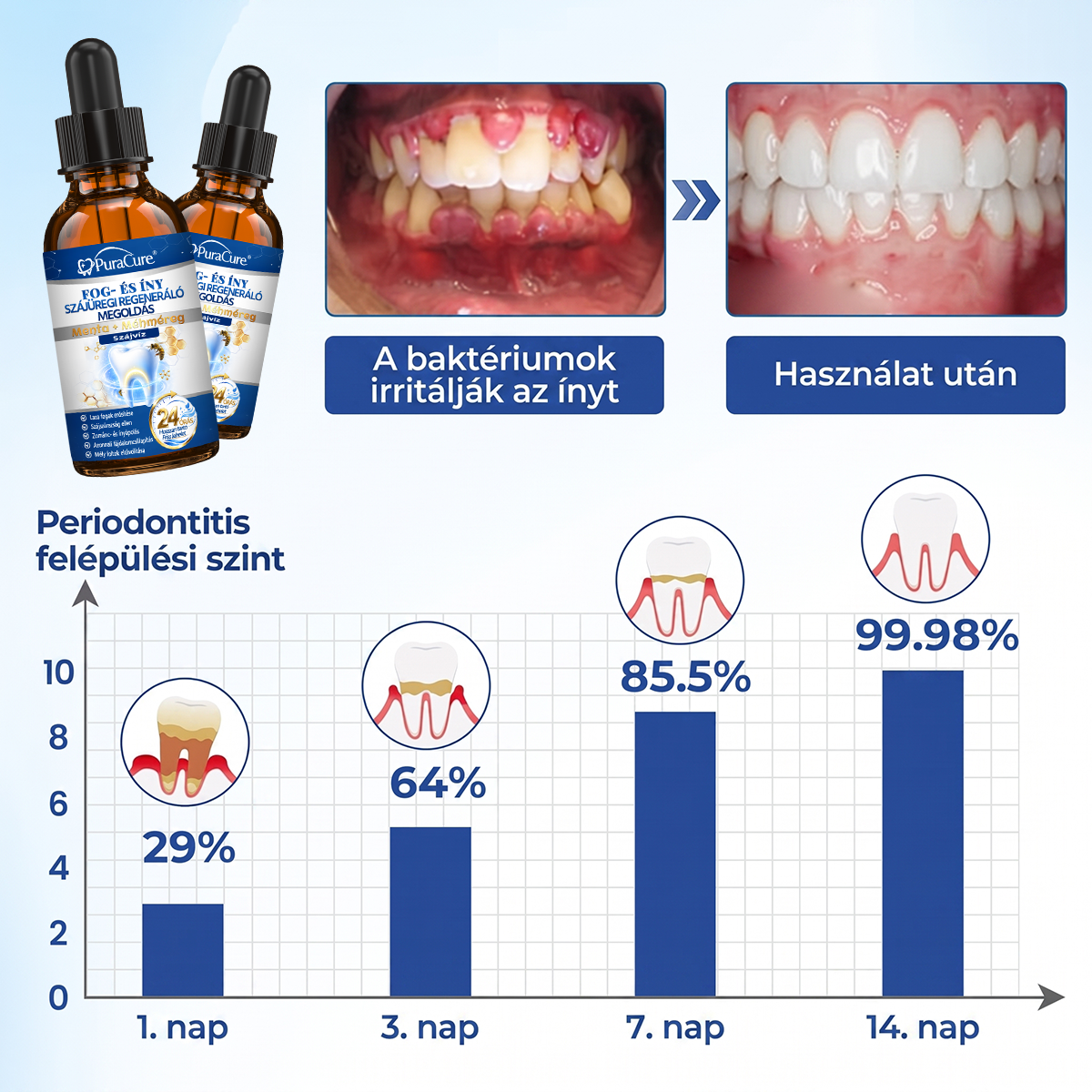 ⭐⭐𝐇𝐢𝐯𝐚𝐭𝐚𝐥𝐨𝐬 Á𝐫𝐮𝐡á𝐳 | 𝐏𝐮𝐫𝐚𝐂𝐮𝐫𝐞® 𝐅𝐨𝐠- é𝐬 Í𝐧𝐲 𝐒𝐳á𝐣ü𝐫𝐞𝐠𝐢 𝐑𝐞𝐠𝐞𝐧𝐞𝐫á𝐥ó 𝐎𝐥𝐝𝐚𝐭 | 𝐌é𝐡𝐦é𝐫𝐞𝐠-𝐩𝐞𝐩𝐭𝐢𝐝𝐞𝐤 × 𝐊𝐨𝐥𝐥𝐚𝐠é𝐧 × 𝐏𝐨𝐬𝐳𝐭𝐛𝐢𝐨𝐭𝐢𝐤𝐮𝐦𝐨𝐤 × 𝐁é𝐭𝐚-𝐠𝐥ü𝐤𝐚𝐧á𝐳 𝐞𝐫𝐞𝐣é𝐯𝐞𝐥 𝐚 𝐥𝐞𝐩𝐞𝐝é𝐤, 𝐟𝐨𝐠𝐤ő, 𝐟𝐨𝐠𝐟á𝐣á𝐬, 𝐫𝐨𝐬𝐬𝐳 𝐥𝐞𝐡𝐞𝐥𝐞𝐭 é𝐬 𝐠𝐲𝐞𝐧𝐠𝐞 𝐟𝐨𝐠𝐚𝐤 𝐞𝐥𝐥𝐞𝐧