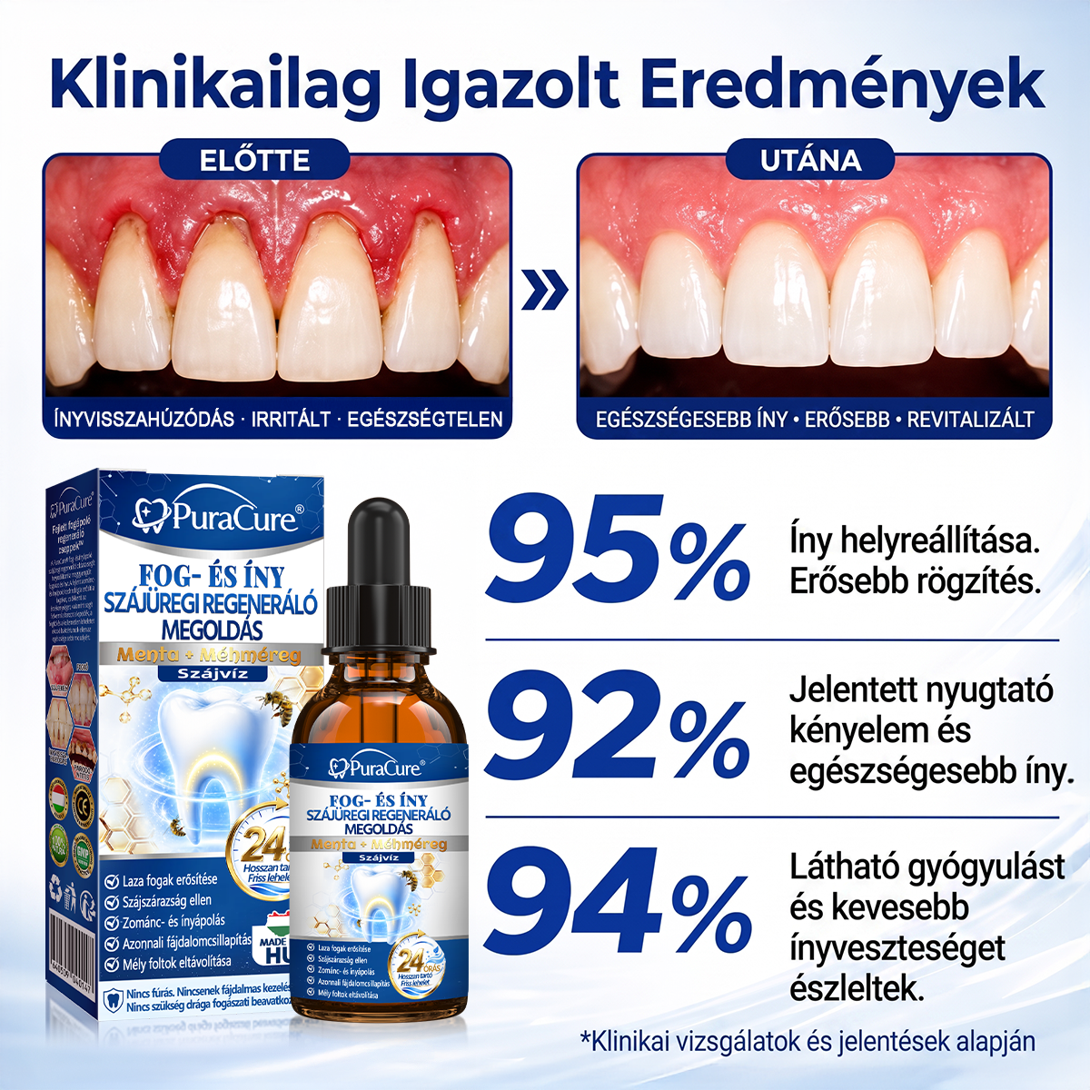 ⭐⭐𝐇𝐢𝐯𝐚𝐭𝐚𝐥𝐨𝐬 Á𝐫𝐮𝐡á𝐳 | 𝐏𝐮𝐫𝐚𝐂𝐮𝐫𝐞® 𝐅𝐨𝐠- é𝐬 Í𝐧𝐲 𝐒𝐳á𝐣ü𝐫𝐞𝐠𝐢 𝐑𝐞𝐠𝐞𝐧𝐞𝐫á𝐥ó 𝐎𝐥𝐝𝐚𝐭 | 𝐌é𝐡𝐦é𝐫𝐞𝐠-𝐩𝐞𝐩𝐭𝐢𝐝𝐞𝐤 × 𝐊𝐨𝐥𝐥𝐚𝐠é𝐧 × 𝐏𝐨𝐬𝐳𝐭𝐛𝐢𝐨𝐭𝐢𝐤𝐮𝐦𝐨𝐤 × 𝐁é𝐭𝐚-𝐠𝐥ü𝐤𝐚𝐧á𝐳 𝐞𝐫𝐞𝐣é𝐯𝐞𝐥 𝐚 𝐥𝐞𝐩𝐞𝐝é𝐤, 𝐟𝐨𝐠𝐤ő, 𝐟𝐨𝐠𝐟á𝐣á𝐬, 𝐫𝐨𝐬𝐬𝐳 𝐥𝐞𝐡𝐞𝐥𝐞𝐭 é𝐬 𝐠𝐲𝐞𝐧𝐠𝐞 𝐟𝐨𝐠𝐚𝐤 𝐞𝐥𝐥𝐞𝐧
