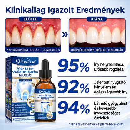⭐⭐𝐇𝐢𝐯𝐚𝐭𝐚𝐥𝐨𝐬 Á𝐫𝐮𝐡á𝐳 | 𝐏𝐮𝐫𝐚𝐂𝐮𝐫𝐞® 𝐅𝐨𝐠- é𝐬 Í𝐧𝐲 𝐒𝐳á𝐣ü𝐫𝐞𝐠𝐢 𝐑𝐞𝐠𝐞𝐧𝐞𝐫á𝐥ó 𝐎𝐥𝐝𝐚𝐭 | 𝐌é𝐡𝐦é𝐫𝐞𝐠-𝐩𝐞𝐩𝐭𝐢𝐝𝐞𝐤 × 𝐊𝐨𝐥𝐥𝐚𝐠é𝐧 × 𝐏𝐨𝐬𝐳𝐭𝐛𝐢𝐨𝐭𝐢𝐤𝐮𝐦𝐨𝐤 × 𝐁é𝐭𝐚-𝐠𝐥ü𝐤𝐚𝐧á𝐳 𝐞𝐫𝐞𝐣é𝐯𝐞𝐥 𝐚 𝐥𝐞𝐩𝐞𝐝é𝐤, 𝐟𝐨𝐠𝐤ő, 𝐟𝐨𝐠𝐟á𝐣á𝐬, 𝐫𝐨𝐬𝐬𝐳 𝐥𝐞𝐡𝐞𝐥𝐞𝐭 é𝐬 𝐠𝐲𝐞𝐧𝐠𝐞 𝐟𝐨𝐠𝐚𝐤 𝐞𝐥𝐥𝐞𝐧