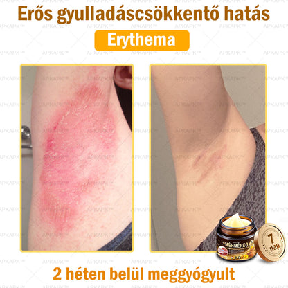 𝐀𝐏𝐊𝐀𝐏𝐊™ 𝐌é𝐡𝐦é𝐫𝐞𝐠 𝐁ő𝐫𝐫𝐞𝐠𝐞𝐧𝐞𝐫á𝐥ó 𝐊𝐫é𝐦 🧑‍⚕️ 🧑‍⚕️𝐀 𝐛ő𝐫𝐩𝐫𝐨𝐛𝐥é𝐦á𝐤 𝐤𝐞𝐳𝐞𝐥é𝐬𝐞 𝐦𝐚𝐠á𝐛𝐚𝐧 𝐟𝐨𝐠𝐥𝐚𝐥𝐣𝐚: é𝐥𝐞𝐭𝐤𝐨𝐫𝐢 𝐟𝐨𝐥𝐭𝐨𝐤, 𝐡𝐞𝐠𝐞𝐤, 𝐬𝐳𝐞𝐦ö𝐥𝐜𝐬ö𝐤, 𝐛ő𝐫𝐧ö𝐯𝐞𝐝é𝐤𝐞𝐤, 𝐭á𝐥𝐲𝐨𝐠𝐨𝐤, 𝐩𝐚𝐭𝐭𝐚𝐧á𝐬𝐨𝐤, 𝐞𝐤𝐜é𝐦𝐚, 𝐩𝐬𝐨𝐫𝐢𝐚𝐬𝐢𝐬, 𝐚𝐜𝐧𝐞 𝐢𝐧𝐯𝐞𝐫𝐬𝐚, 𝐫á𝐧𝐜𝐨𝐤, 𝐛ő𝐫ö𝐫𝐞𝐠𝐞𝐝é𝐬 é𝐬 𝐞𝐠𝐲é𝐛 𝐩𝐫𝐨𝐛𝐥é𝐦á𝐤 🔥