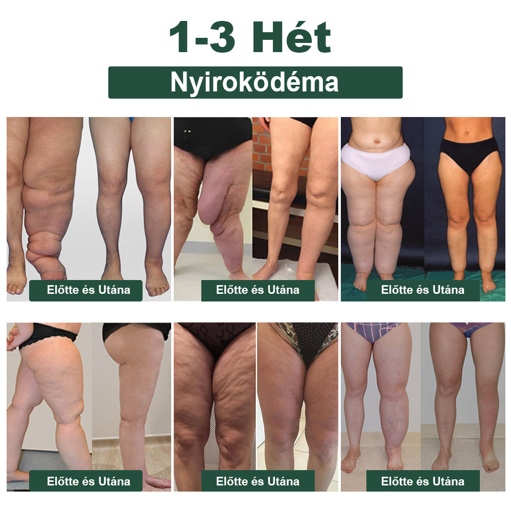 𝐁𝐞𝐧𝐞𝐭𝐮𝐫𝐞™ Méhméreg karcsúsító nyirokcsomó méregtelenítő gyulladáscsökkentő fájdalomcsillapító lábáztató gyöngyök - Mayo Clinic Recommended (több mint 2 millió fogyasztó bízik benne világszerte)