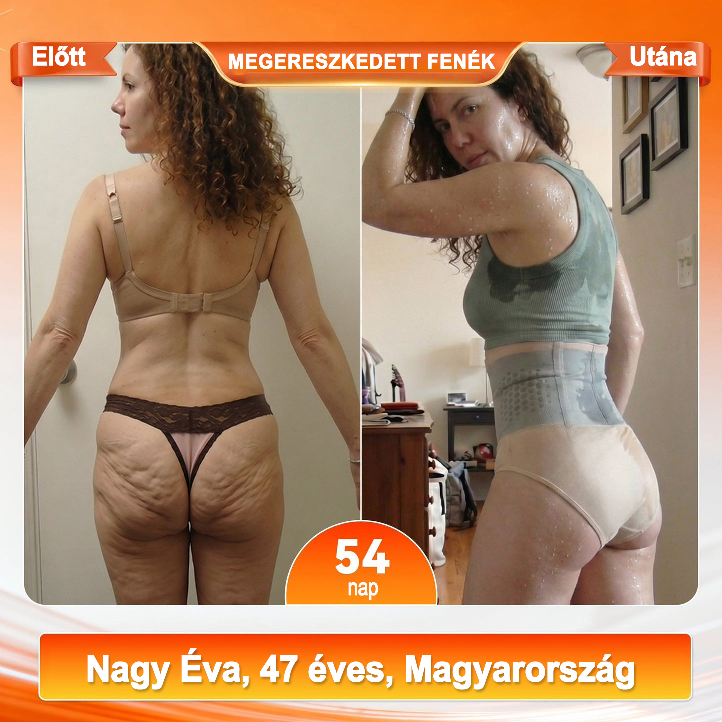 🔥🔥Hivatalos Márkabolt | ZUWIAY® 2026 Moringa & Berberine 4-in-1 Mikrorészecskés Alakformáló és Zsírégető Rövidnadrág