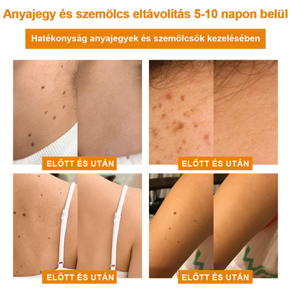 🎁 🍃🎁Már csak 5 doboz maradt! További 50% kedvezményt adunk! Tedd egészségesebbé a tested! Ha most lemaradsz róla, akkor csak jövőre kapod meg.