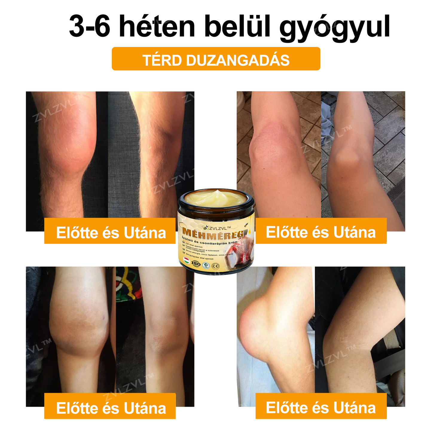 ZVLZVL™ 🐝Méhméreg Azonnali Ultra Erős Fájdalomcsillapító Krém - (Enyhíti a fájdalmat ízületi gyulladás, izomfájdalom, hátfájás, térdek, hát, vállak, csípők, csuklók, kezek esetén)