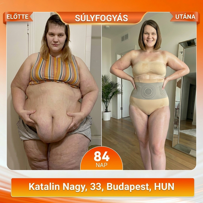 🔥🔥Hivatalos Márkabolt | ZUWIAY® 2026 Moringa & Berberine 4-in-1 Mikrorészecskés Alakformáló és Zsírégető Rövidnadrág
