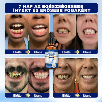 ⭐⭐𝐇𝐢𝐯𝐚𝐭𝐚𝐥𝐨𝐬 Á𝐫𝐮𝐡á𝐳 | 𝐏𝐮𝐫𝐚𝐂𝐮𝐫𝐞® 𝐅𝐨𝐠- é𝐬 Í𝐧𝐲 𝐒𝐳á𝐣ü𝐫𝐞𝐠𝐢 𝐑𝐞𝐠𝐞𝐧𝐞𝐫á𝐥ó 𝐎𝐥𝐝𝐚𝐭 | 𝐌é𝐡𝐦é𝐫𝐞𝐠-𝐩𝐞𝐩𝐭𝐢𝐝𝐞𝐤 × 𝐊𝐨𝐥𝐥𝐚𝐠é𝐧 × 𝐏𝐨𝐬𝐳𝐭𝐛𝐢𝐨𝐭𝐢𝐤𝐮𝐦𝐨𝐤 × 𝐁é𝐭𝐚-𝐠𝐥ü𝐤𝐚𝐧á𝐳 𝐞𝐫𝐞𝐣é𝐯𝐞𝐥 𝐚 𝐥𝐞𝐩𝐞𝐝é𝐤, 𝐟𝐨𝐠𝐤ő, 𝐟𝐨𝐠𝐟á𝐣á𝐬, 𝐫𝐨𝐬𝐬𝐳 𝐥𝐞𝐡𝐞𝐥𝐞𝐭 é𝐬 𝐠𝐲𝐞𝐧𝐠𝐞 𝐟𝐨𝐠𝐚𝐤 𝐞𝐥𝐥𝐞𝐧