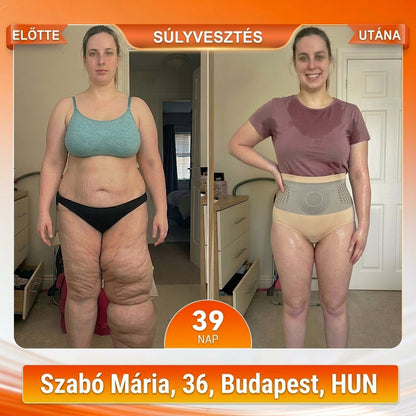 🔥🔥Hivatalos Márkabolt | ZUWIAY® 2026 Moringa & Berberine 4-in-1 Mikrorészecskés Alakformáló és Zsírégető Rövidnadrág