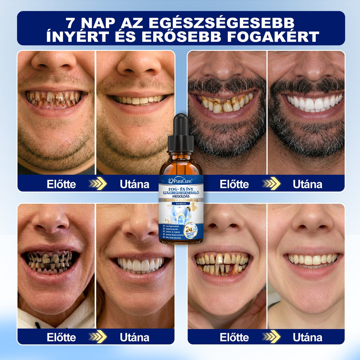 ⭐⭐𝐇𝐢𝐯𝐚𝐭𝐚𝐥𝐨𝐬 Á𝐫𝐮𝐡á𝐳 | 𝐏𝐮𝐫𝐚𝐂𝐮𝐫𝐞® 𝐅𝐨𝐠- é𝐬 Í𝐧𝐲 𝐒𝐳á𝐣ü𝐫𝐞𝐠𝐢 𝐑𝐞𝐠𝐞𝐧𝐞𝐫á𝐥ó 𝐎𝐥𝐝𝐚𝐭 | 𝐌é𝐡𝐦é𝐫𝐞𝐠-𝐩𝐞𝐩𝐭𝐢𝐝𝐞𝐤 × 𝐊𝐨𝐥𝐥𝐚𝐠é𝐧 × 𝐏𝐨𝐬𝐳𝐭𝐛𝐢𝐨𝐭𝐢𝐤𝐮𝐦𝐨𝐤 × 𝐁é𝐭𝐚-𝐠𝐥ü𝐤𝐚𝐧á𝐳 𝐞𝐫𝐞𝐣é𝐯𝐞𝐥 𝐚 𝐥𝐞𝐩𝐞𝐝é𝐤, 𝐟𝐨𝐠𝐤ő, 𝐟𝐨𝐠𝐟á𝐣á𝐬, 𝐫𝐨𝐬𝐬𝐳 𝐥𝐞𝐡𝐞𝐥𝐞𝐭 é𝐬 𝐠𝐲𝐞𝐧𝐠𝐞 𝐟𝐨𝐠𝐚𝐤 𝐞𝐥𝐥𝐞𝐧