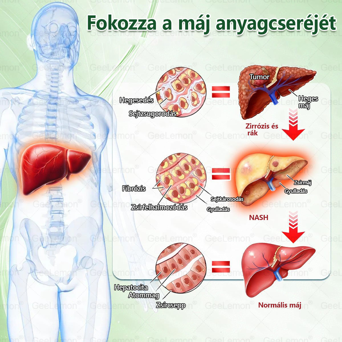 🌿Ajánlott a Semmelweis Kórház által · 👩‍⚕️BENU hivatalos üzlet| 🎁 𝐆𝐞𝑒𝐿𝑒𝐦𝐨𝐧® Glumasetide 8 az 1-ben Karcsú és Egészséges Nano Mikrotűs Tapasz