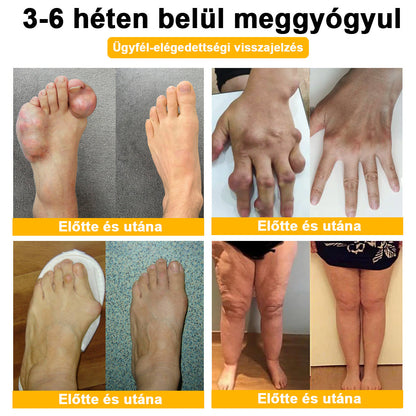 🌿🍯🌿BEARNICA™ Bee Venom Advanced ízület- és csontkezelő krém🔥 (Utolsó napi akció, 70% kedvezmény)