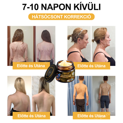ZVLZVL™🍯Méhméreg Azonnali Ultra Erős Fájdalomcsillapító Krém -❄ Új téli akció | ❄ Akár 70% kedvezmény