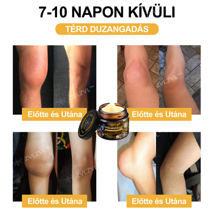 ZVLZVL™🍯Méhméreg Azonnali Ultra Erős Fájdalomcsillapító Krém -❄ Új téli akció | ❄ Akár 70% kedvezmény