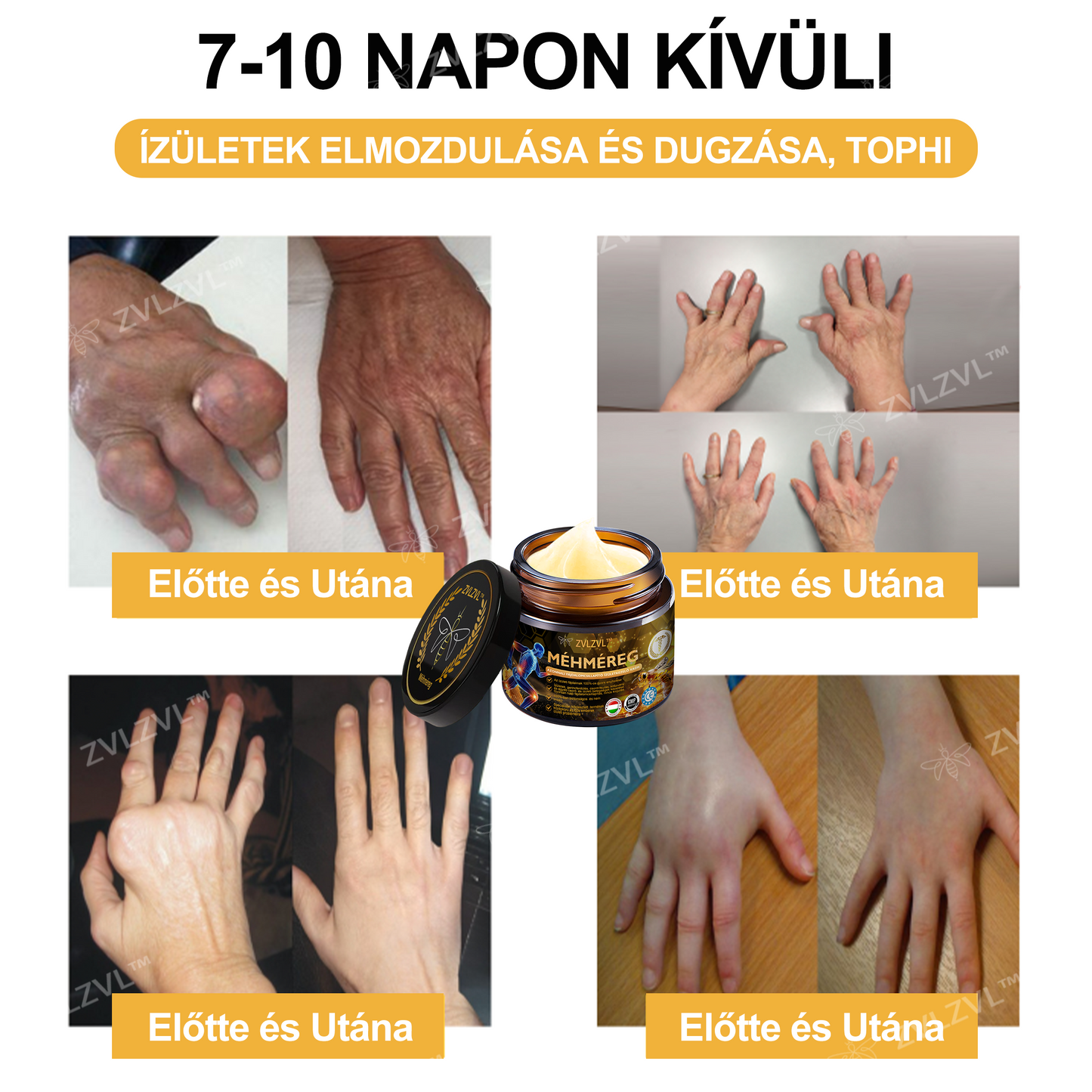 ZVLZVL™🍯Méhméreg Azonnali Ultra Erős Fájdalomcsillapító Krém -❄ Új téli akció | ❄ Akár 70% kedvezmény