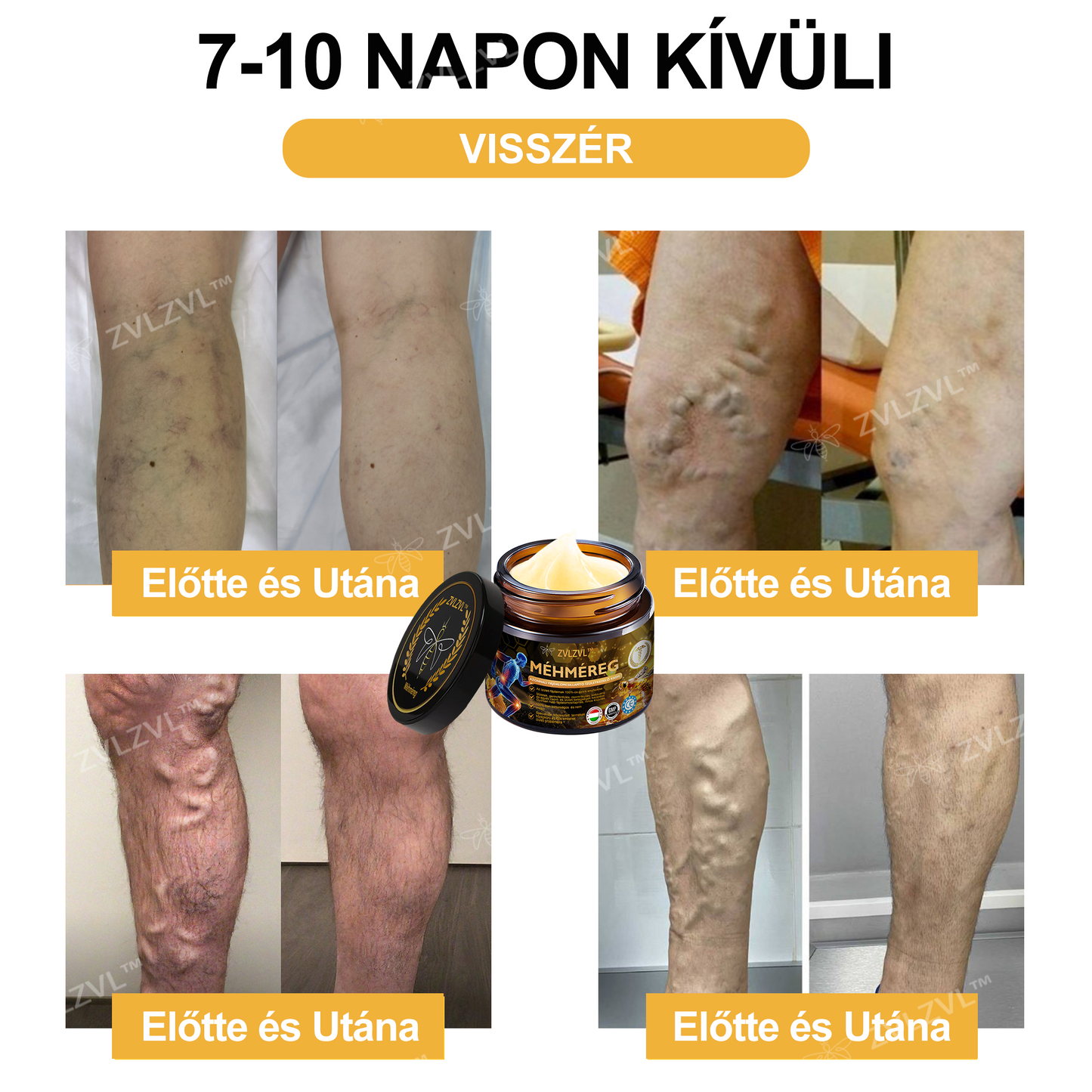 ZVLZVL™🍯Méhméreg Azonnali Ultra Erős Fájdalomcsillapító Krém -❄ Új téli akció | ❄ Akár 70% kedvezmény