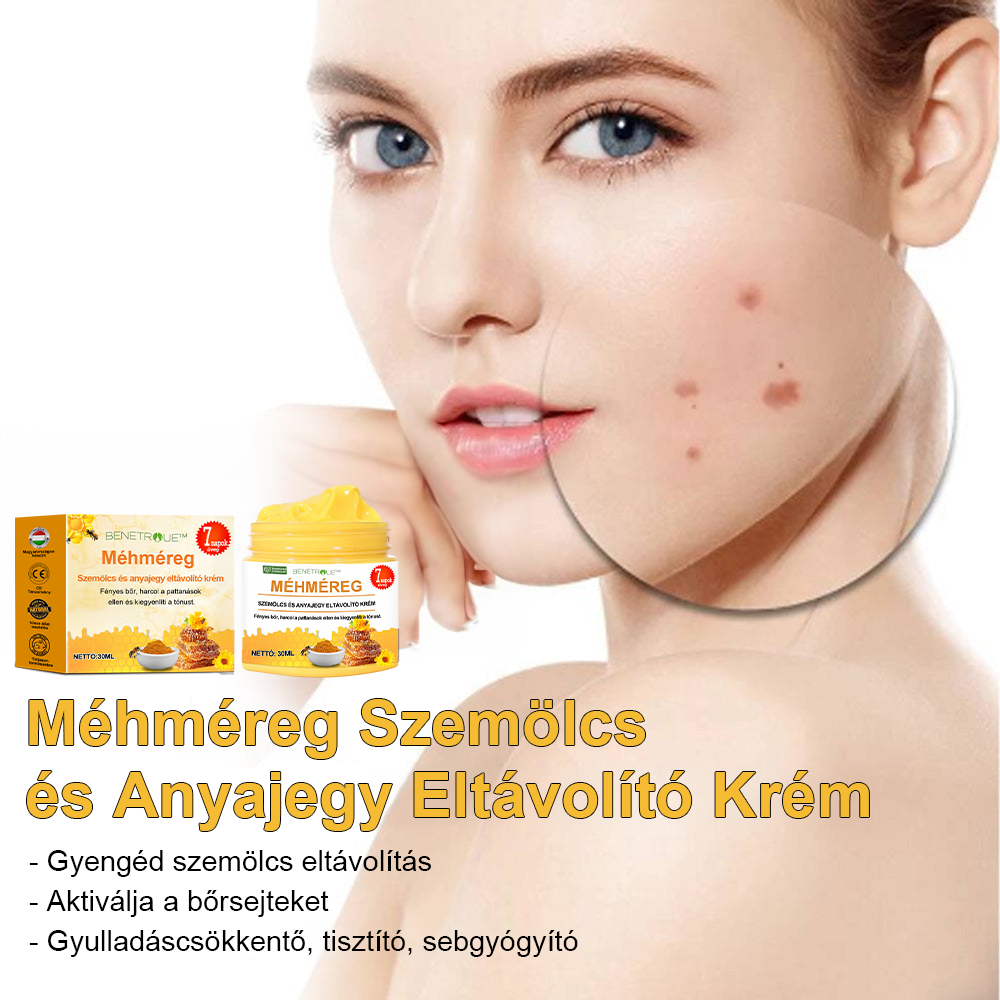 🐝🍯🐝BENETURE™ méhméreg szemölcs és anyajegy eltávolító krém🔥 (Utolsó napi akció, 80% kedvezmény)