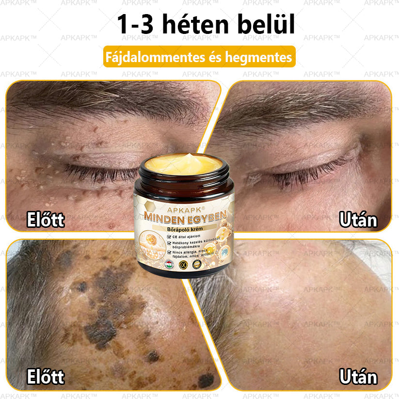 𝐀𝐏𝐊𝐀𝐏𝐊™🐝 𝐇𝐚𝐭é𝐤𝐨𝐧𝐲, 𝐦𝐢𝐧𝐝𝐞𝐧𝐭 𝐞𝐠𝐲𝐛𝐞𝐧 𝐛ő𝐫á𝐩𝐨𝐥ó 𝐤𝐫é𝐦(❄ Új téli akció | ❄ Akár 70% kedvezmény)