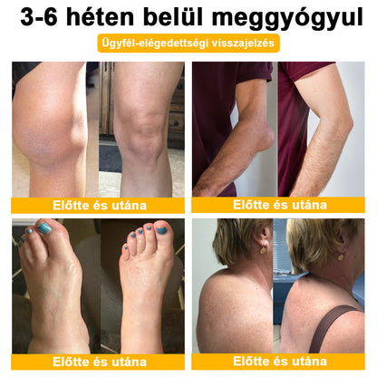 🌿🍯🌿BEARNICA™ Bee Venom Advanced ízület- és csontkezelő krém🔥 (Utolsó napi akció, 70% kedvezmény)