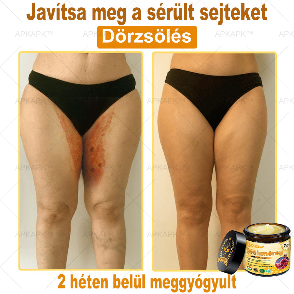 🔥 Már csak 5 doboz maradt! További 50% kedvezményt adunk! Ha most lemaradsz, csak jövőre kaphatod meg - APKAPK