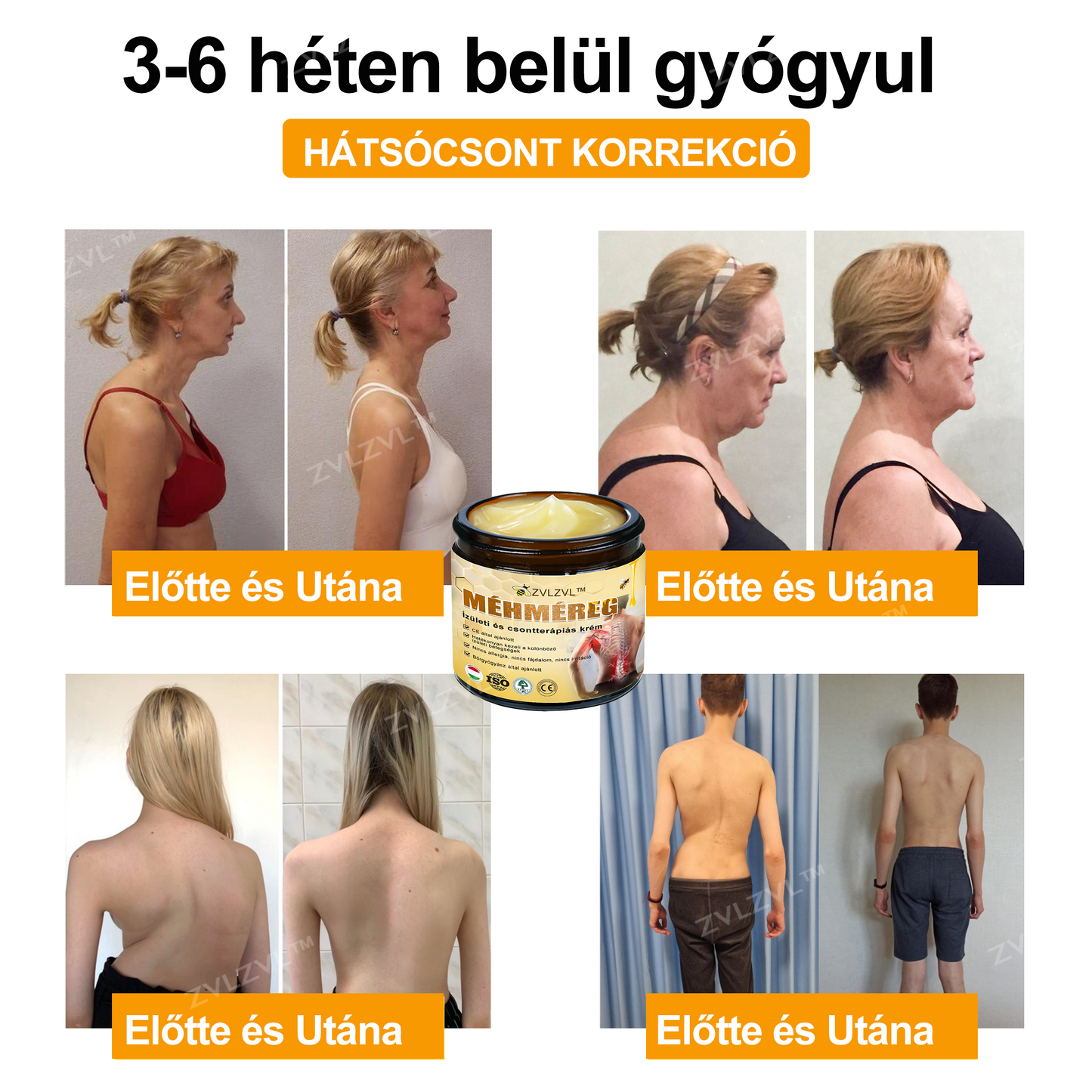 ZVLZVL™ 🐝Méhméreg Azonnali Ultra Erős Fájdalomcsillapító Krém - (Enyhíti a fájdalmat ízületi gyulladás, izomfájdalom, hátfájás, térdek, hát, vállak, csípők, csuklók, kezek esetén)