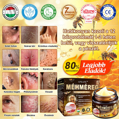 𝐀𝐏𝐊𝐀𝐏𝐊™ 𝐌é𝐡𝐦é𝐫𝐞𝐠 𝐁ő𝐫𝐫𝐞𝐠𝐞𝐧𝐞𝐫á𝐥ó 𝐊𝐫é𝐦 🧑‍⚕️ 🧑‍⚕️𝐀 𝐛ő𝐫𝐩𝐫𝐨𝐛𝐥é𝐦á𝐤 𝐤𝐞𝐳𝐞𝐥é𝐬𝐞 𝐦𝐚𝐠á𝐛𝐚𝐧 𝐟𝐨𝐠𝐥𝐚𝐥𝐣𝐚: é𝐥𝐞𝐭𝐤𝐨𝐫𝐢 𝐟𝐨𝐥𝐭𝐨𝐤, 𝐡𝐞𝐠𝐞𝐤, 𝐬𝐳𝐞𝐦ö𝐥𝐜𝐬ö𝐤, 𝐛ő𝐫𝐧ö𝐯𝐞𝐝é𝐤𝐞𝐤, 𝐭á𝐥𝐲𝐨𝐠𝐨𝐤, 𝐩𝐚𝐭𝐭𝐚𝐧á𝐬𝐨𝐤, 𝐞𝐤𝐜é𝐦𝐚, 𝐩𝐬𝐨𝐫𝐢𝐚𝐬𝐢𝐬, 𝐚𝐜𝐧𝐞 𝐢𝐧𝐯𝐞𝐫𝐬𝐚, 𝐫á𝐧𝐜𝐨𝐤, 𝐛ő𝐫ö𝐫𝐞𝐠𝐞𝐝é𝐬 é𝐬 𝐞𝐠𝐲é𝐛 𝐩𝐫𝐨𝐛𝐥é𝐦á𝐤 🔥