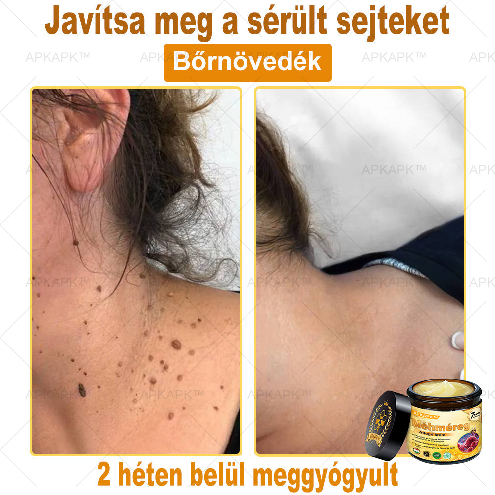 🔥 Már csak 5 doboz maradt! További 50% kedvezményt adunk! Ha most lemaradsz, csak jövőre kaphatod meg - APKAPK