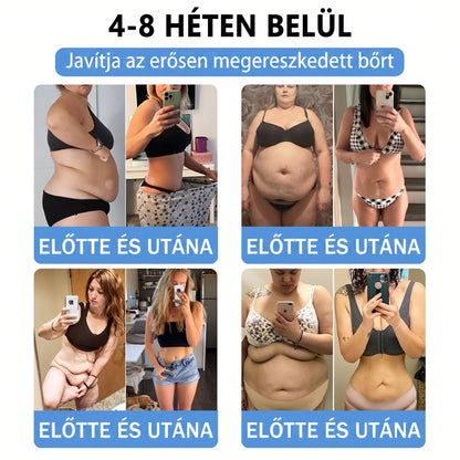 🌿Moringa · Berberine × NAD+ 10-in-1 Advanced Nano HAJUEI® Glumasetide 8az 1-ben Karcsú és EgészségesNano Mikrotűs Tapasz (Napi 1alkalom – látható változásakár 7 nap alatt) ✅ Elhízásra,bőrfeszesítésre,cukorbetegségre, alvásiapnoéra, ízületekre stb