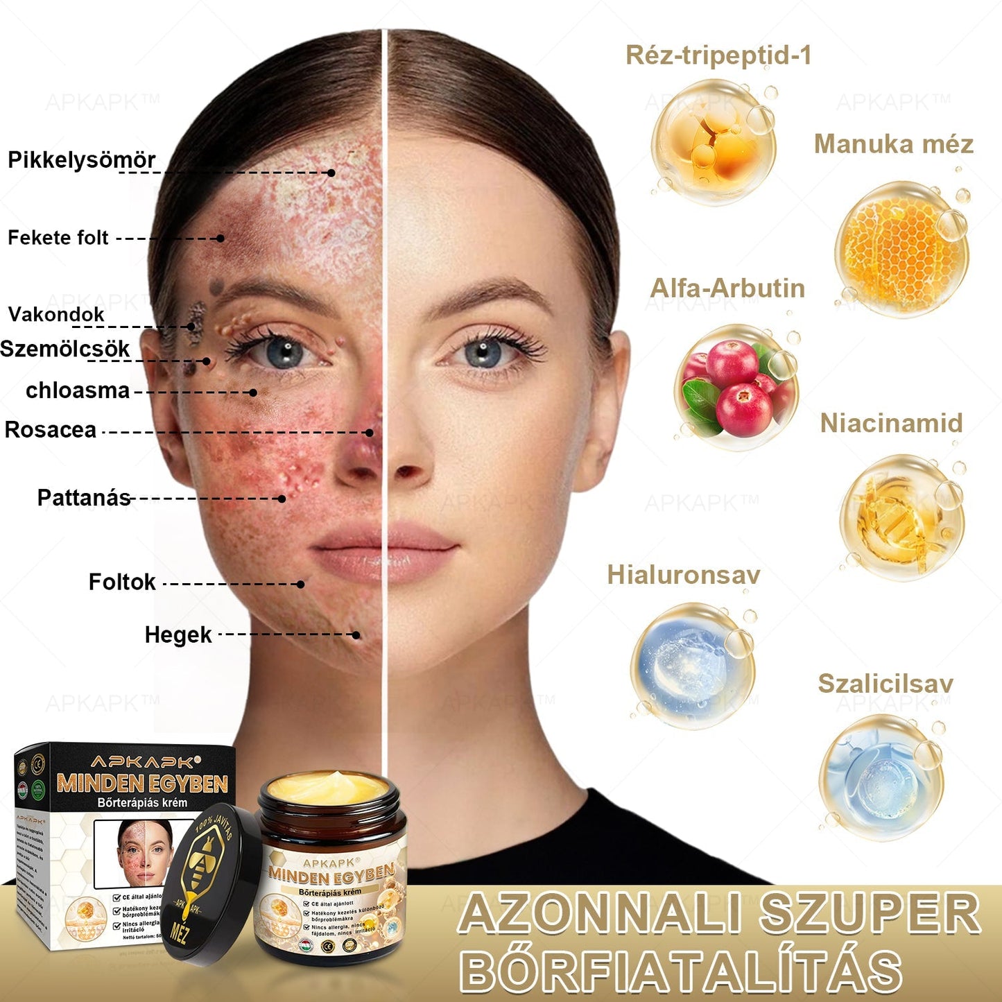 𝐀𝐏𝐊𝐀𝐏𝐊™🐝 𝐇𝐚𝐭é𝐤𝐨𝐧𝐲, 𝐦𝐢𝐧𝐝𝐞𝐧𝐭 𝐞𝐠𝐲𝐛𝐞𝐧 𝐛ő𝐫á𝐩𝐨𝐥ó 𝐤𝐫é𝐦(❄ Új téli akció | ❄ Akár 70% kedvezmény)