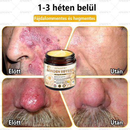 𝐀𝐏𝐊𝐀𝐏𝐊™🐝 𝐇𝐚𝐭é𝐤𝐨𝐧𝐲, 𝐦𝐢𝐧𝐝𝐞𝐧𝐭 𝐞𝐠𝐲𝐛𝐞𝐧 𝐛ő𝐫á𝐩𝐨𝐥ó 𝐤𝐫é𝐦(❄ Új téli akció | ❄ Akár 70% kedvezmény)