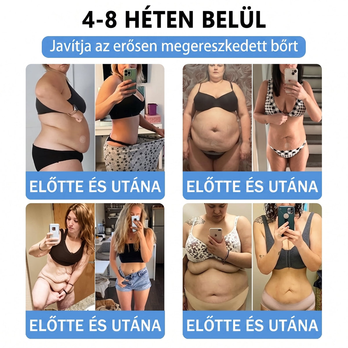 🌿Moringa · Berberine × NAD+ 10-in-1 Advanced Nano HAJUEI® Glumasetide 8az 1-ben Karcsú és EgészségesNano Mikrotűs Tapasz (Napi 1alkalom – látható változásakár 7 nap alatt) ✅ Elhízásra,bőrfeszesítésre,cukorbetegségre, alvásiapnoéra, ízületekre stb