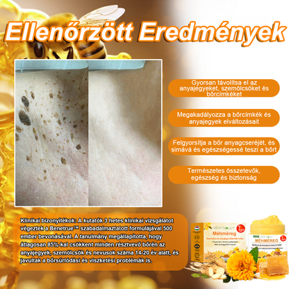 🐝🍯🐝BENETURE™ méhméreg szemölcs és anyajegy eltávolító krém🔥 (Utolsó napi akció, 80% kedvezmény)