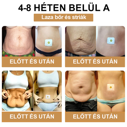 🎁 Már csak 5 doboz maradt! További 50% kedvezményt adunk! Legyél fitt és egészséges! Ha most kihagyod, jövőre már nem lesz rá lehetőséged.