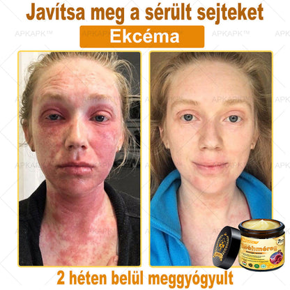 🔥 Már csak 5 doboz maradt! További 50% kedvezményt adunk! Ha most lemaradsz, csak jövőre kaphatod meg - APKAPK