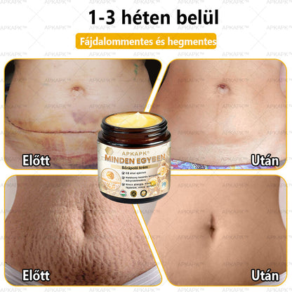 𝐀𝐏𝐊𝐀𝐏𝐊™🐝 𝐇𝐚𝐭é𝐤𝐨𝐧𝐲, 𝐦𝐢𝐧𝐝𝐞𝐧𝐭 𝐞𝐠𝐲𝐛𝐞𝐧 𝐛ő𝐫á𝐩𝐨𝐥ó 𝐤𝐫é𝐦(❄ Új téli akció | ❄ Akár 70% kedvezmény)