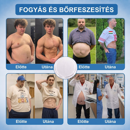 🌿Moringa · Berberine × NAD+ 10-in-1 Advanced Nano HAJUEI® Glumasetide 8az 1-ben Karcsú és EgészségesNano Mikrotűs Tapasz (Napi 1alkalom – látható változásakár 7 nap alatt) ✅ Elhízásra,bőrfeszesítésre,cukorbetegségre, alvásiapnoéra, ízületekre stb