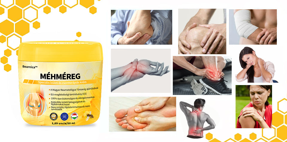 🌿🍯🌿BEARNICA™ Bee Venom Advanced ízület- és csontkezelő krém🔥 (Utolsó napi akció, 70% kedvezmény)