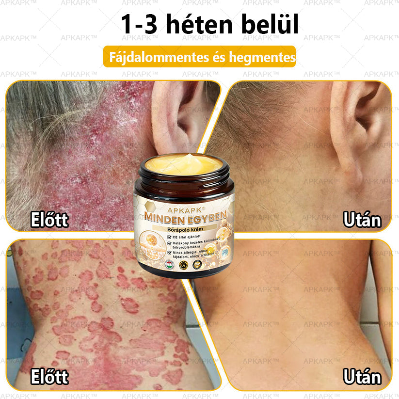 𝐀𝐏𝐊𝐀𝐏𝐊™🐝 𝐇𝐚𝐭é𝐤𝐨𝐧𝐲, 𝐦𝐢𝐧𝐝𝐞𝐧𝐭 𝐞𝐠𝐲𝐛𝐞𝐧 𝐛ő𝐫á𝐩𝐨𝐥ó 𝐤𝐫é𝐦(❄ Új téli akció | ❄ Akár 70% kedvezmény)