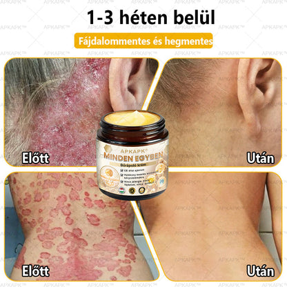 𝐀𝐏𝐊𝐀𝐏𝐊™🐝 𝐇𝐚𝐭é𝐤𝐨𝐧𝐲, 𝐦𝐢𝐧𝐝𝐞𝐧𝐭 𝐞𝐠𝐲𝐛𝐞𝐧 𝐛ő𝐫á𝐩𝐨𝐥ó 𝐤𝐫é𝐦(❄ Új téli akció | ❄ Akár 70% kedvezmény)