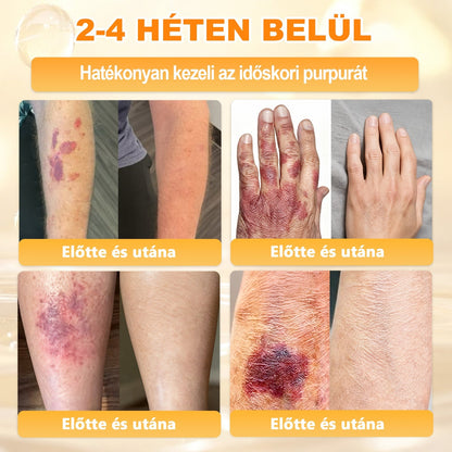 Ajánlott a Semmelweis Kórház által · BENU hivatalos üzlet✨✨ 𝖠𝖯𝖪𝖠𝖯𝖪® méhméreges bőrmegújító krém