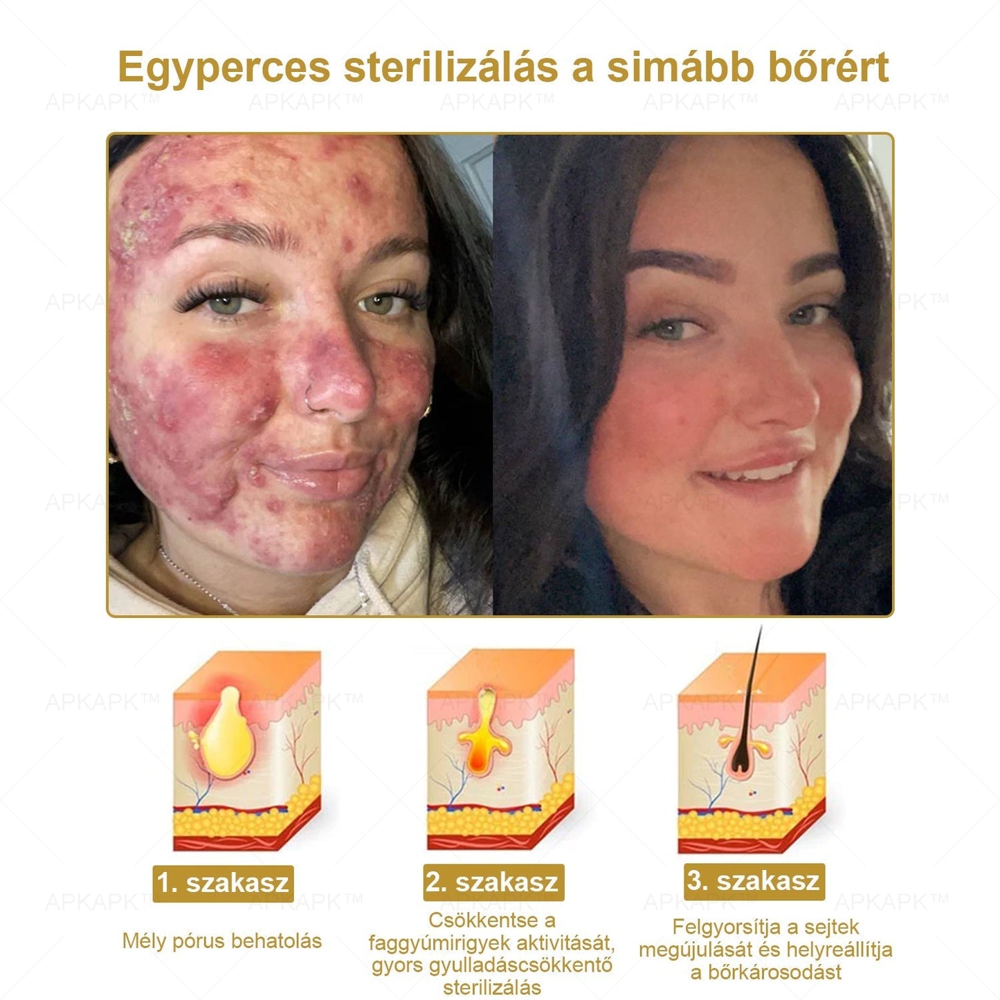 𝐀𝐏𝐊𝐀𝐏𝐊™ 𝐇𝐚𝐭é𝐤𝐨𝐧𝐲, 𝐦𝐢𝐧𝐝𝐞𝐧𝐭 𝐞𝐠𝐲𝐛𝐞𝐧 𝐛ő𝐫á𝐩𝐨𝐥ó 𝐤𝐫é𝐦