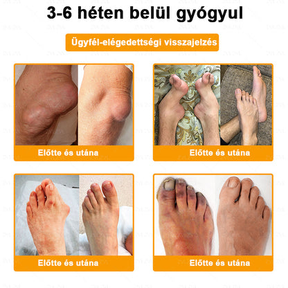 ZVLZVL™ Botulinum Toxin és Méhméreg Fájdalomcsillapító Csontgyógyító Krém ✨🌸(Speziell für ältere Erwachsene & von der EFORT empfohlen)