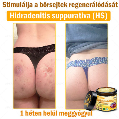 🔥 Már csak 5 doboz maradt! További 50% kedvezményt adunk! Ha most lemaradsz, csak jövőre kaphatod meg - APKAPK