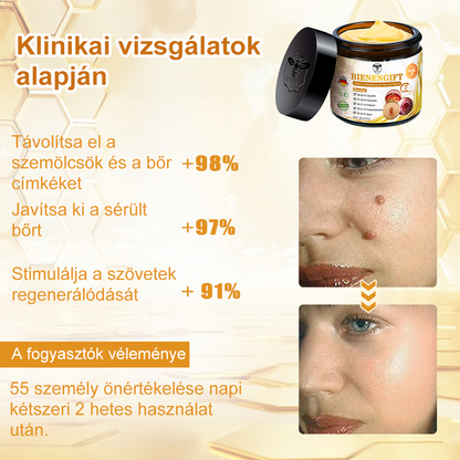 🎁 🍃🎁Már csak 5 doboz maradt! További 50% kedvezményt adunk! Tedd egészségesebbé a tested! Ha most lemaradsz róla, akkor csak jövőre kapod meg.