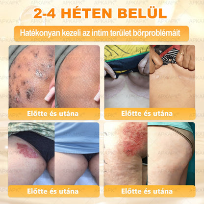 Ajánlott a Semmelweis Kórház által · BENU hivatalos üzlet✨✨ 𝖠𝖯𝖪𝖠𝖯𝖪® méhméreges bőrmegújító krém