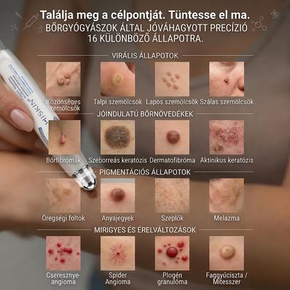 🔥Hivatalos Márkabolt | 🚢🚢 Hiskin® 7 napos Szemölcseltávolító Roll-on Ápoló Folyadék (Fájdalommentes rollerball technológia, hegek nélkül)