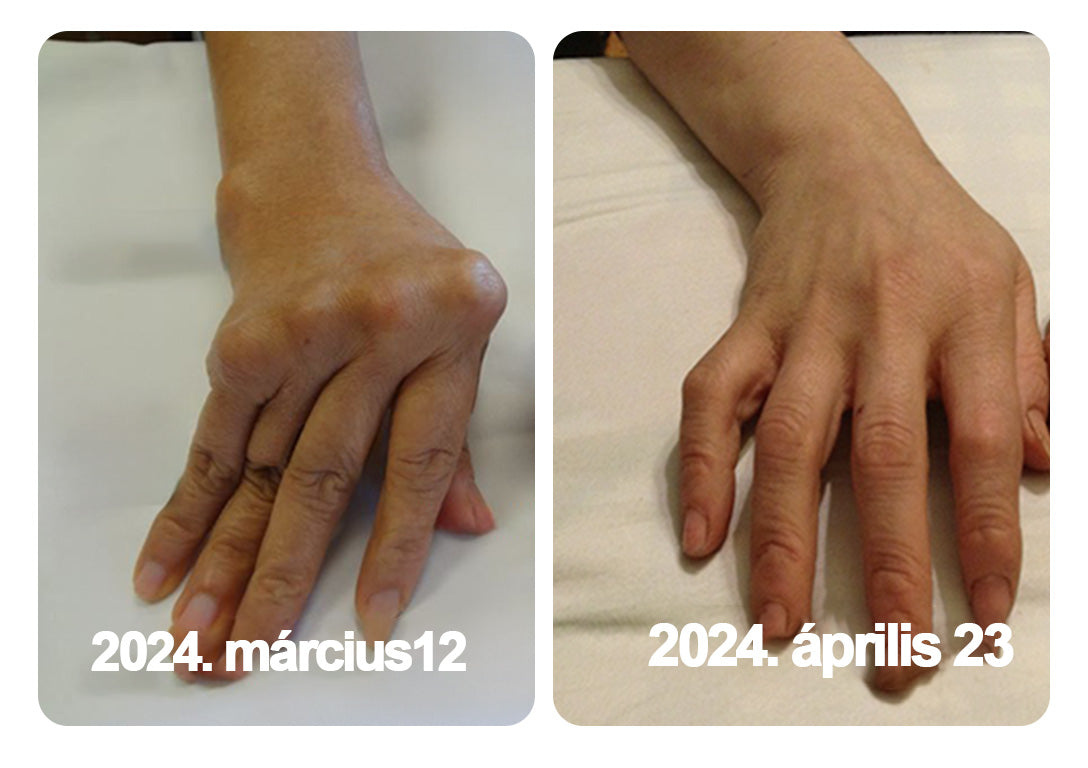 🌿🍯🌿BEARNICA™ Bee Venom Advanced ízület- és csontkezelő krém🔥 (Utolsó napi akció, 70% kedvezmény)