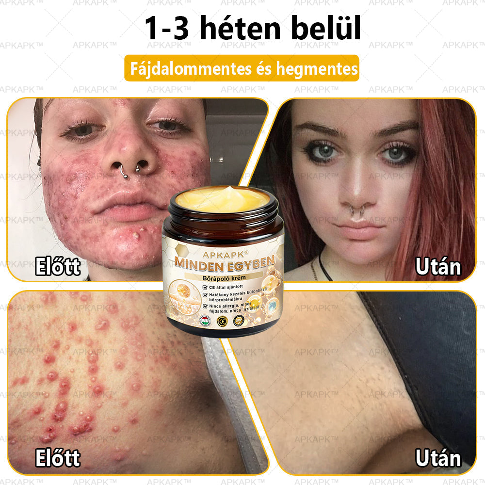 𝐀𝐏𝐊𝐀𝐏𝐊™🐝 𝐇𝐚𝐭é𝐤𝐨𝐧𝐲, 𝐦𝐢𝐧𝐝𝐞𝐧𝐭 𝐞𝐠𝐲𝐛𝐞𝐧 𝐛ő𝐫á𝐩𝐨𝐥ó 𝐤𝐫é𝐦(❄ Új téli akció | ❄ Akár 70% kedvezmény)