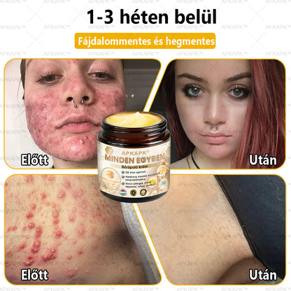 𝐀𝐏𝐊𝐀𝐏𝐊™🐝 𝐇𝐚𝐭é𝐤𝐨𝐧𝐲, 𝐦𝐢𝐧𝐝𝐞𝐧𝐭 𝐞𝐠𝐲𝐛𝐞𝐧 𝐛ő𝐫á𝐩𝐨𝐥ó 𝐤𝐫é𝐦(❄ Új téli akció | ❄ Akár 70% kedvezmény)