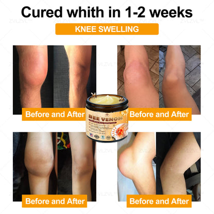 ZVLZVL™ Bee Venom Instant Pain Relief Arthritis Therapy Cream