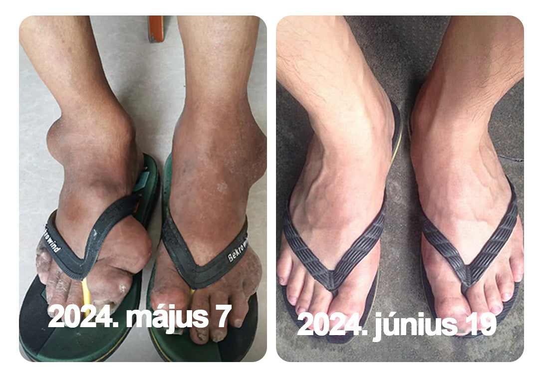 🌿🍯🌿BEARNICA™ Bee Venom Advanced ízület- és csontkezelő krém🔥 (Utolsó napi akció, 70% kedvezmény)